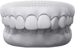 invisalign before after